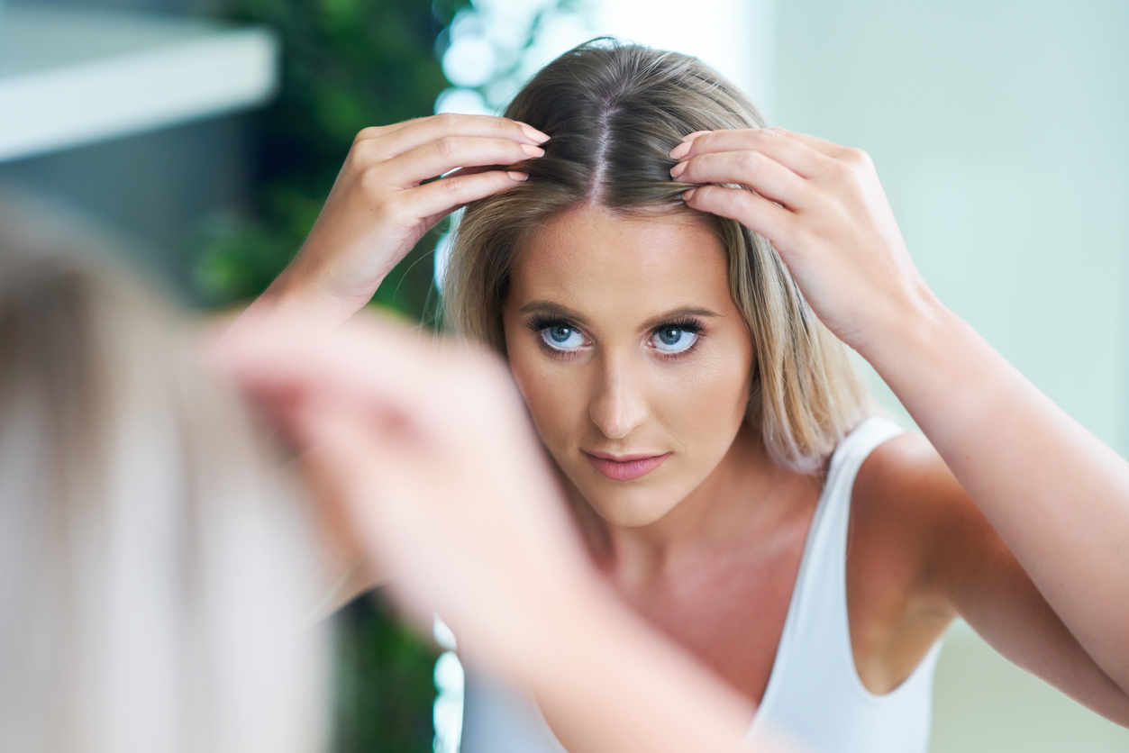 Seborrheic Dermatitis and the Link to Hair Loss | UCF Health